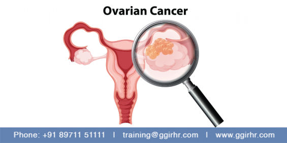 https://www.ggirhr.com/ovarian-cancer/