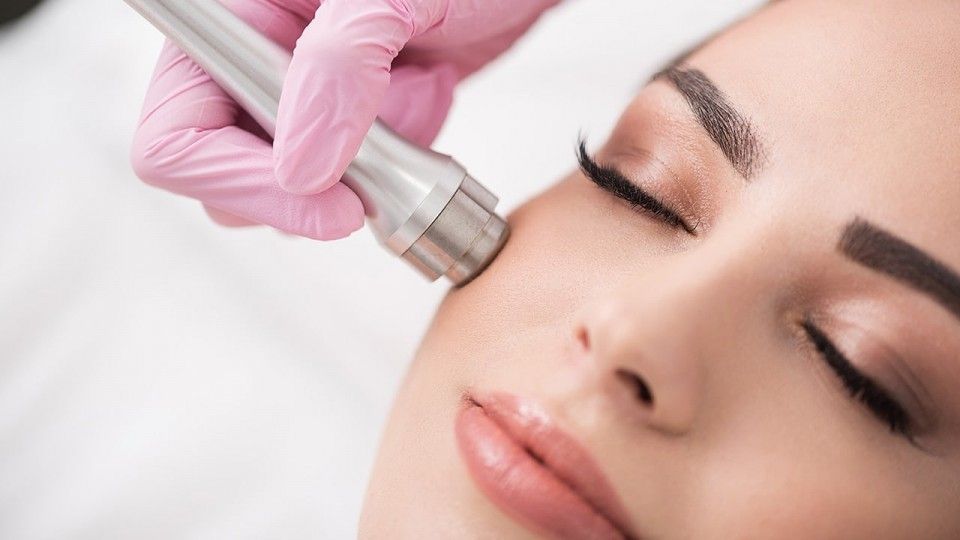 Microdermabrasion