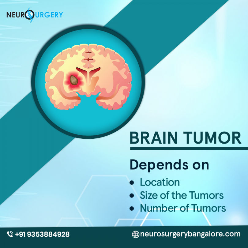 what are the silent symtoms of brain tumor