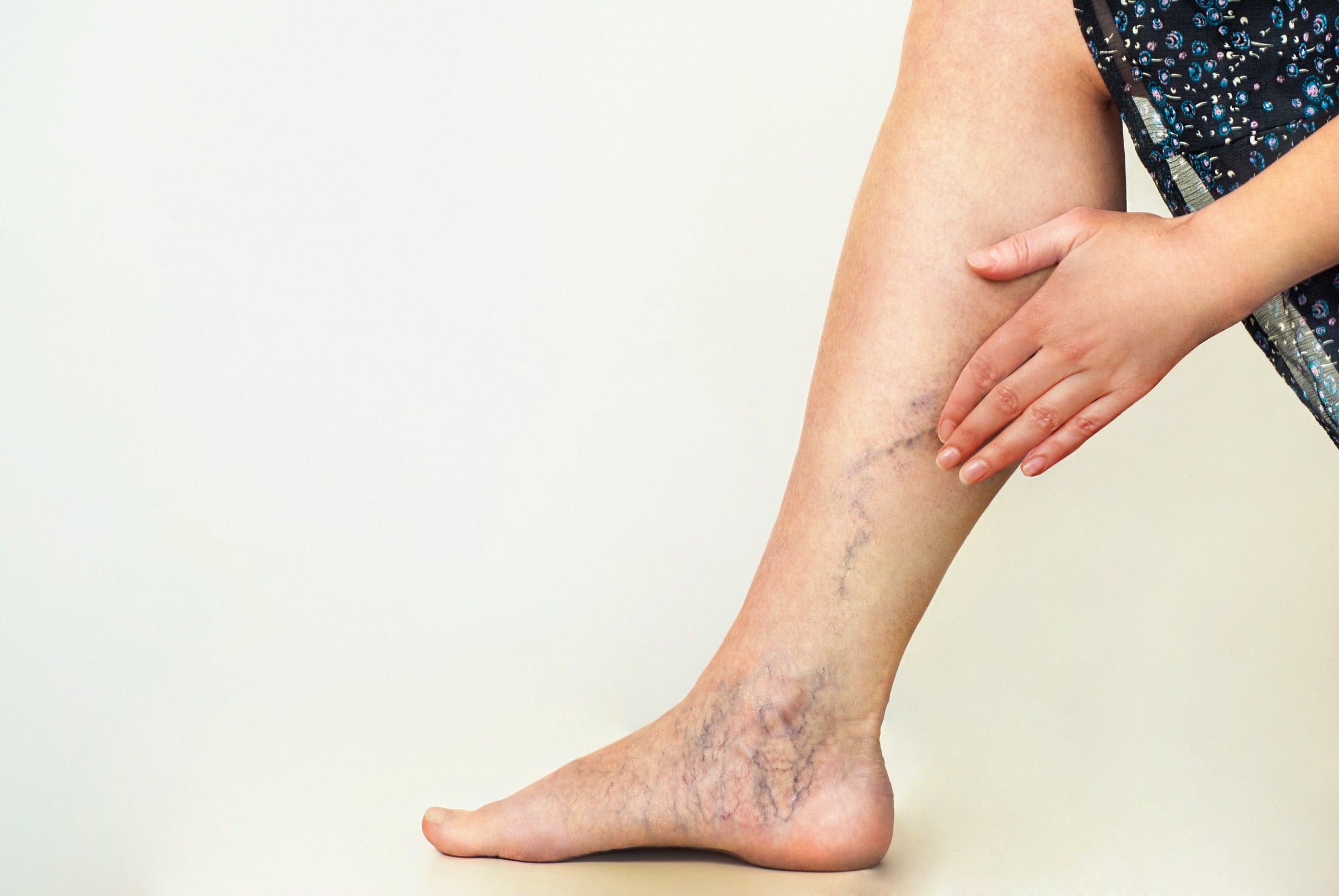 What Happens To Your Veins During Pregnancy?