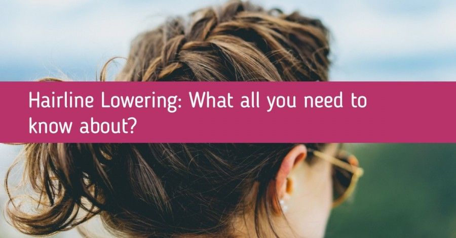 Hairline Lowering - What all you need to know about?