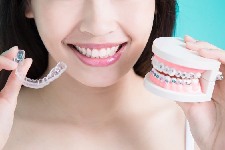 Tooth Extraction by Invisalign