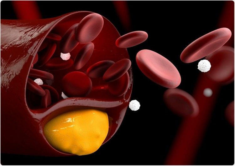 Cholesterol-Lowering Drug Market