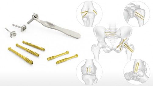 cannulated screws