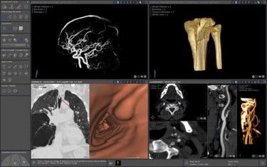 Global 3D Viewing Software Market, 3D Viewing Software Market, 3D Viewing Software, 3D Viewing Software Market Comprehensive Analysis, 3D Viewing Software Market Comprehensive Report, 3D Viewing Softw