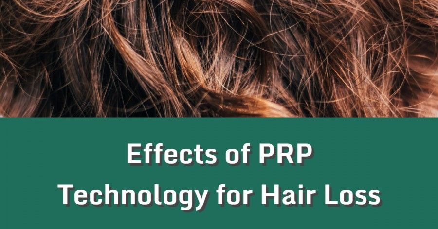 PRP Hair Treatment