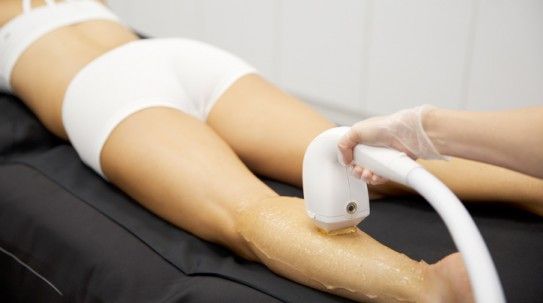 Laser Hair Removal