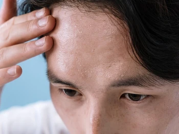 Apa Saja Fungsi Kelenjar Keringat pada Tubuh? Kenali Yuk!