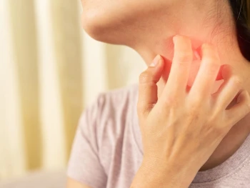 9 Cara Mengatasi Biang Keringat Pada Anak dan Orang Dewasa