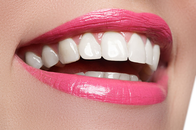 Laugh your heart out with the best Teeth Whitening Treatment