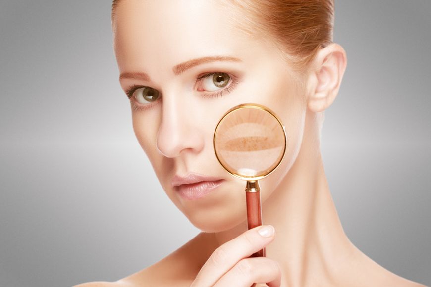 Everything You Need to Know About Melasma Treatment in Dubai