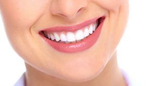 Porcelain veneers in Dubai 