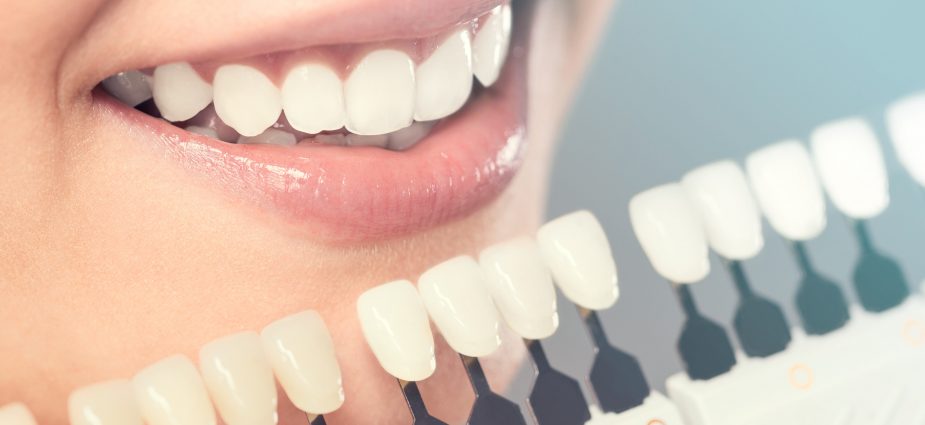 Porcelain veneers in Dubai