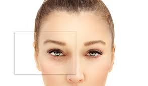 Facelift Procedure – Everything You Need To Know