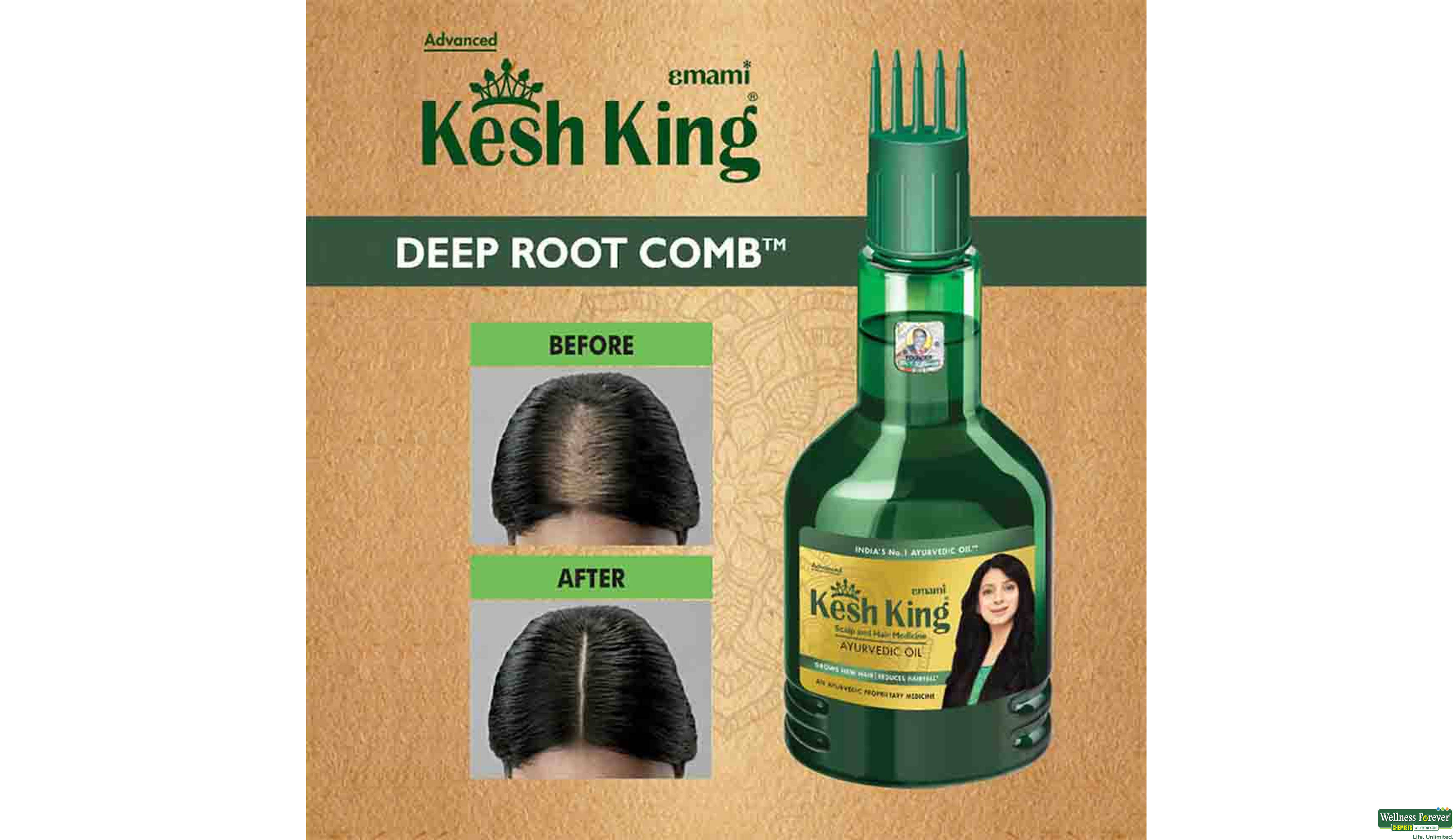 KESH KING HR/OIL 300ML- 7, 300ML, 