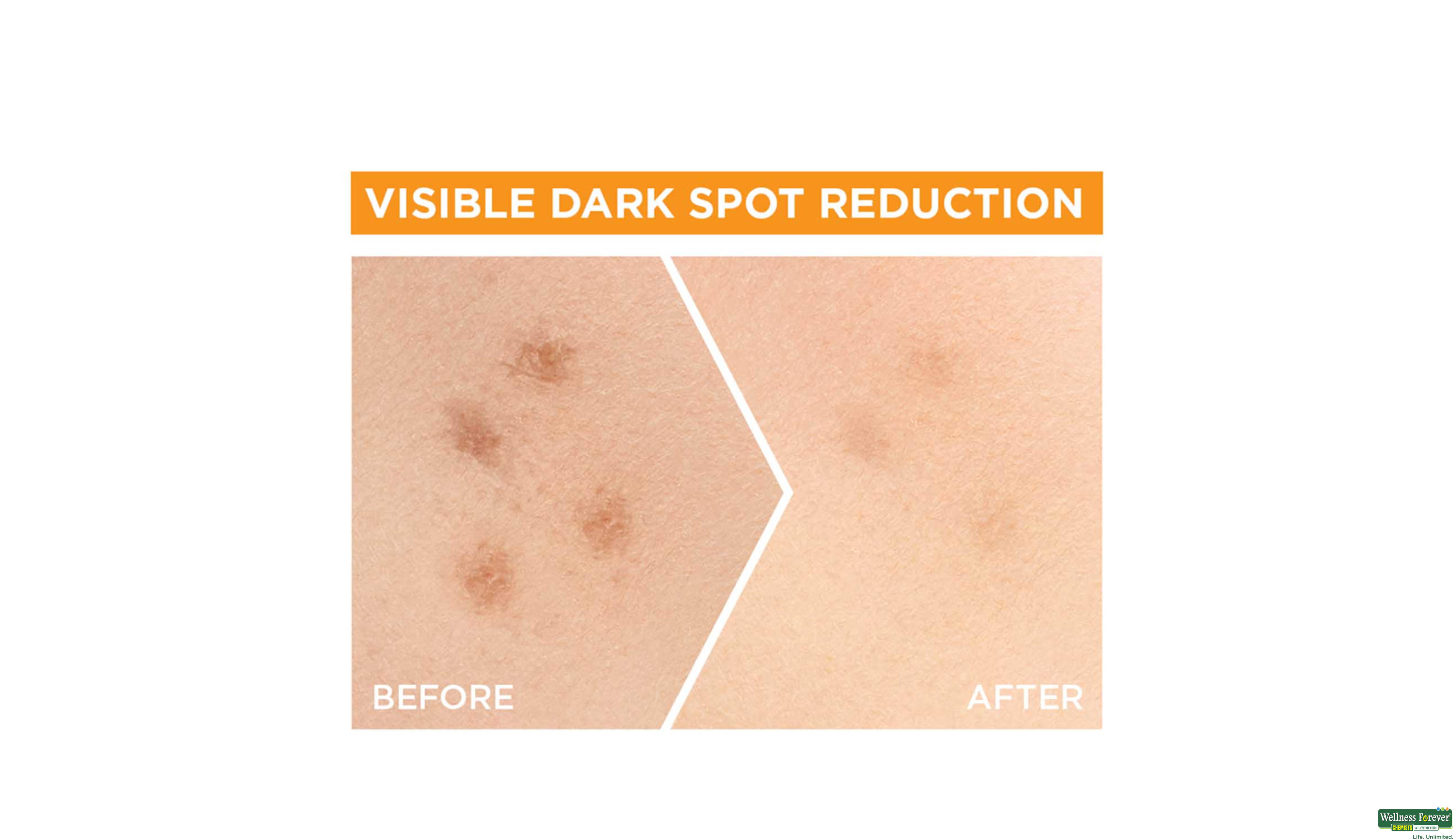 GARN F/SERUM VIT-C LEMON 30ML- 4, 30ML, 
