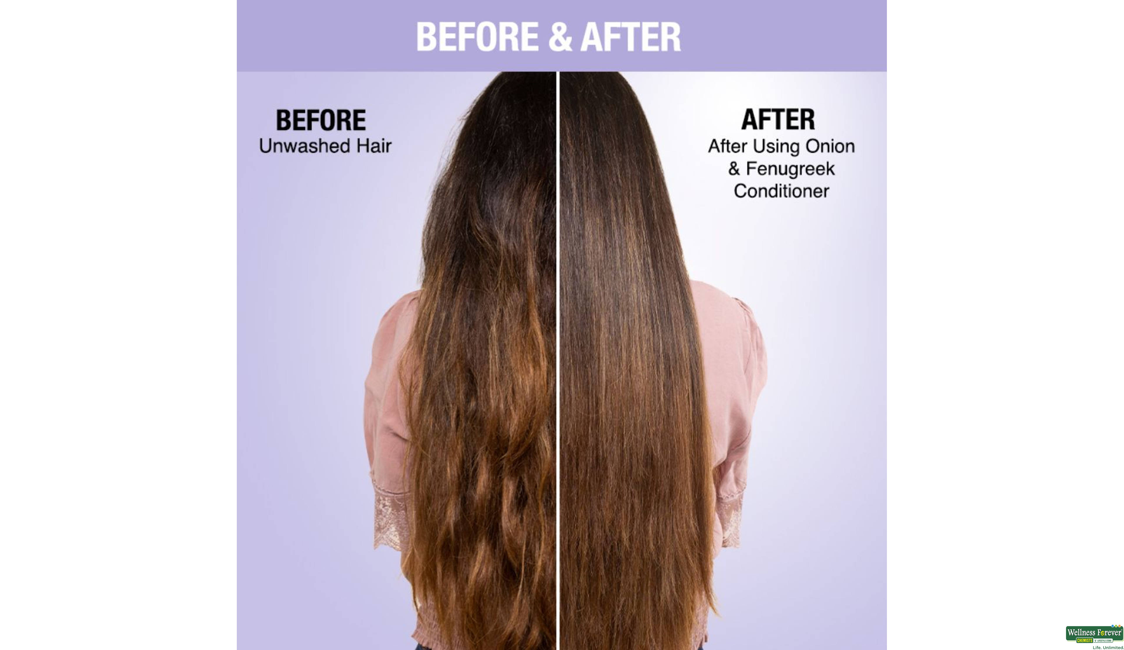 NYKAA CONDITIONER ONION & FENUGREEK 180ML- 9, 1PC, 