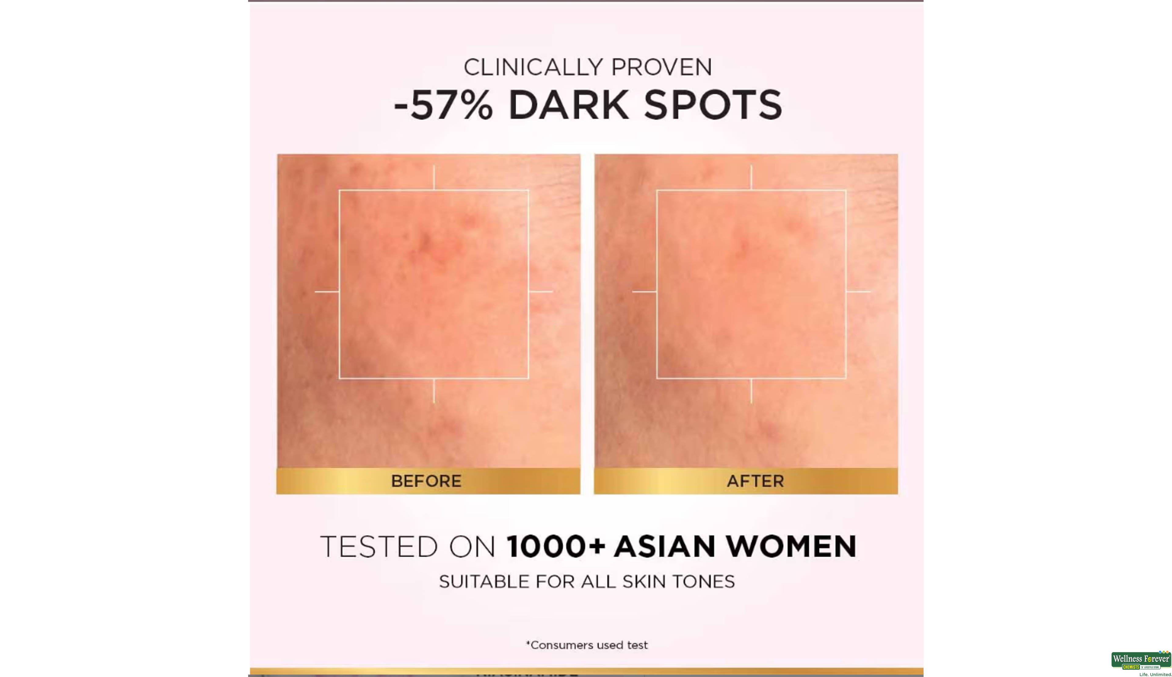 LOREAL GLYCOLIC SKIN BRIGHT SERUM 30ML- 6, 1PC, 