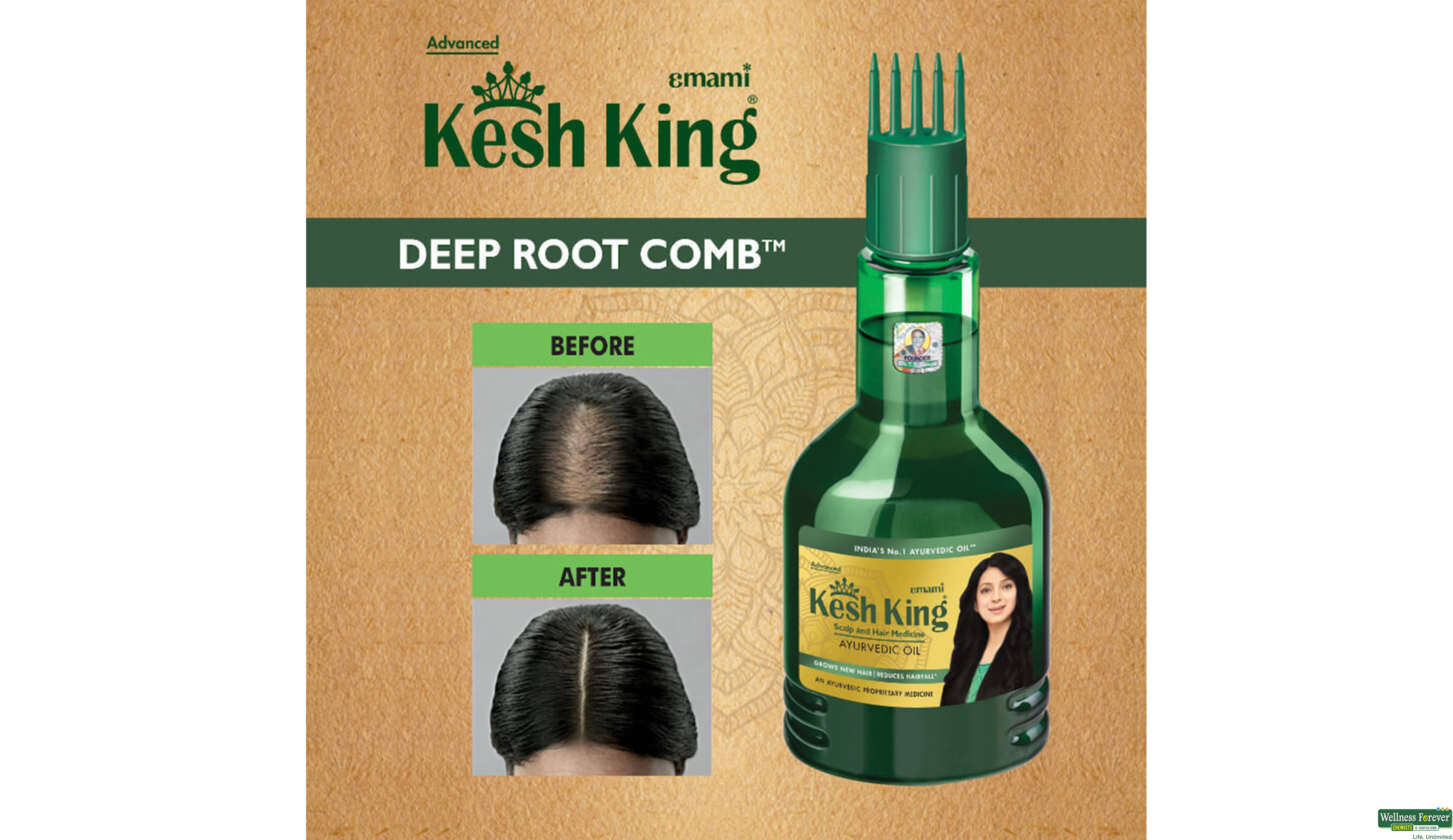 ZANDU KESH KING HAIR OIL 200ML- 7, 200ML, null