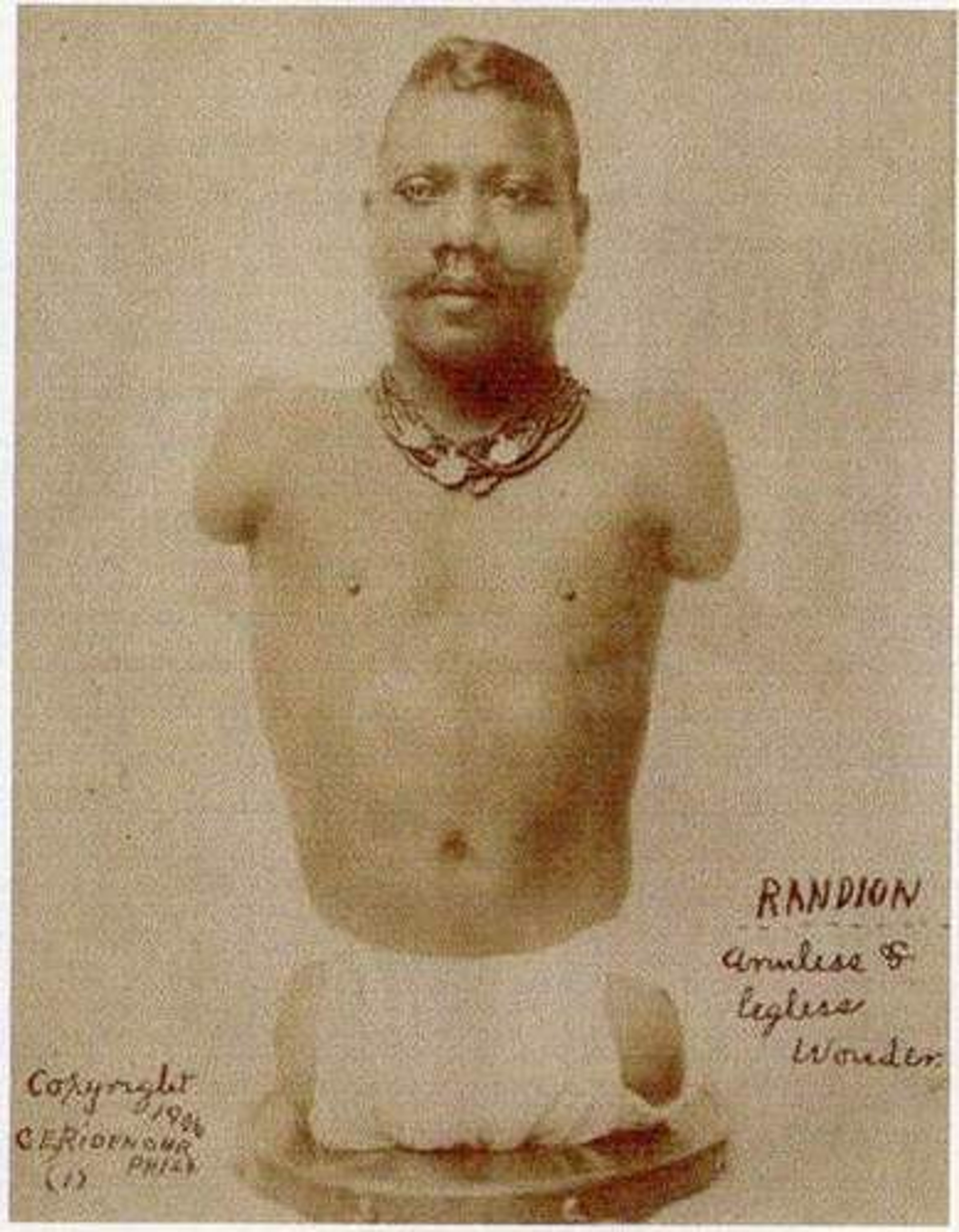 A man without arms or legs, sitting on a chair and wearing a necklace