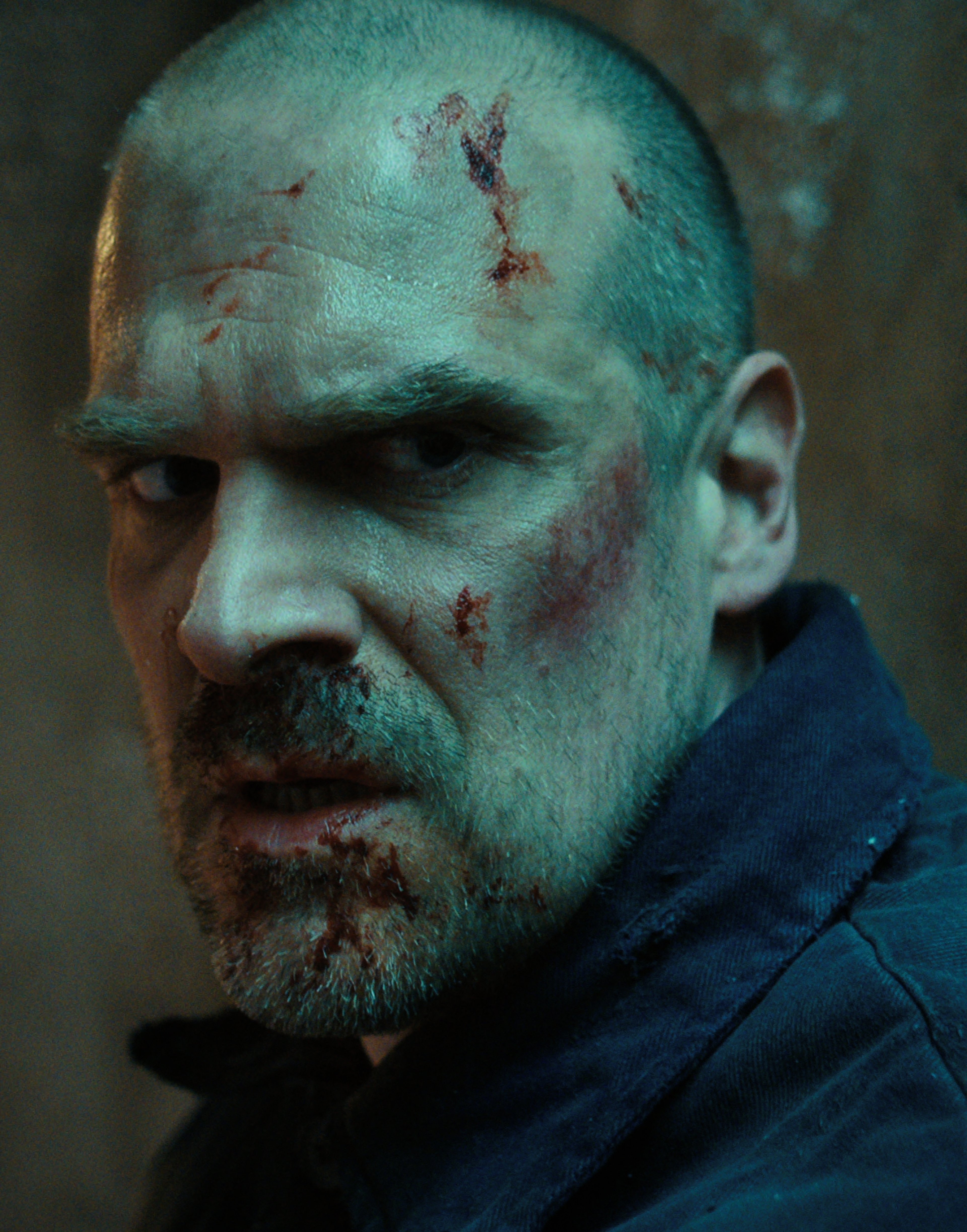 A close-up portrait of a gruff, middle-aged man with a shaved head and a beard, appearing to have been in a physical altercation.