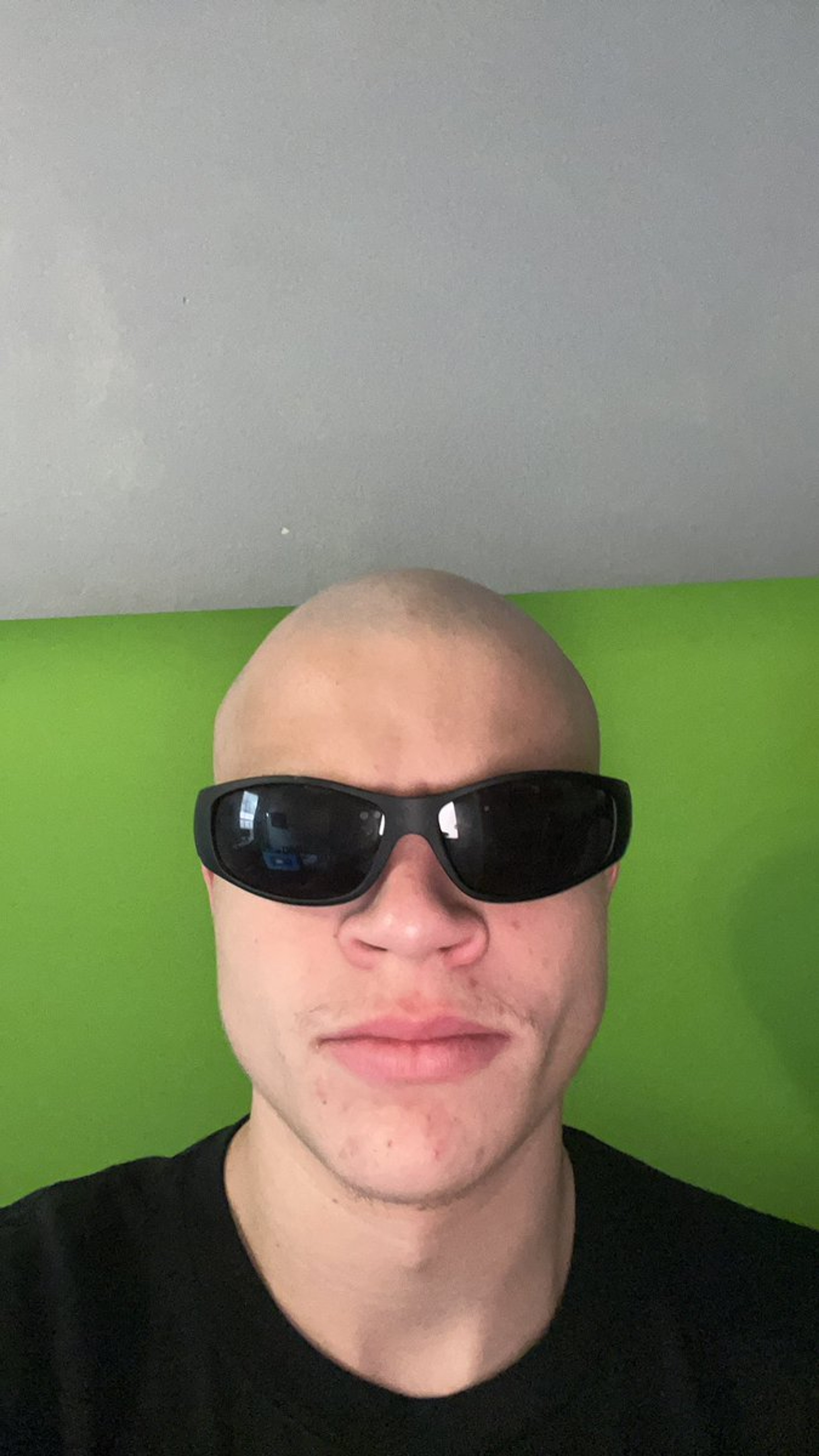 A young man with a bald head wearing black sunglasses