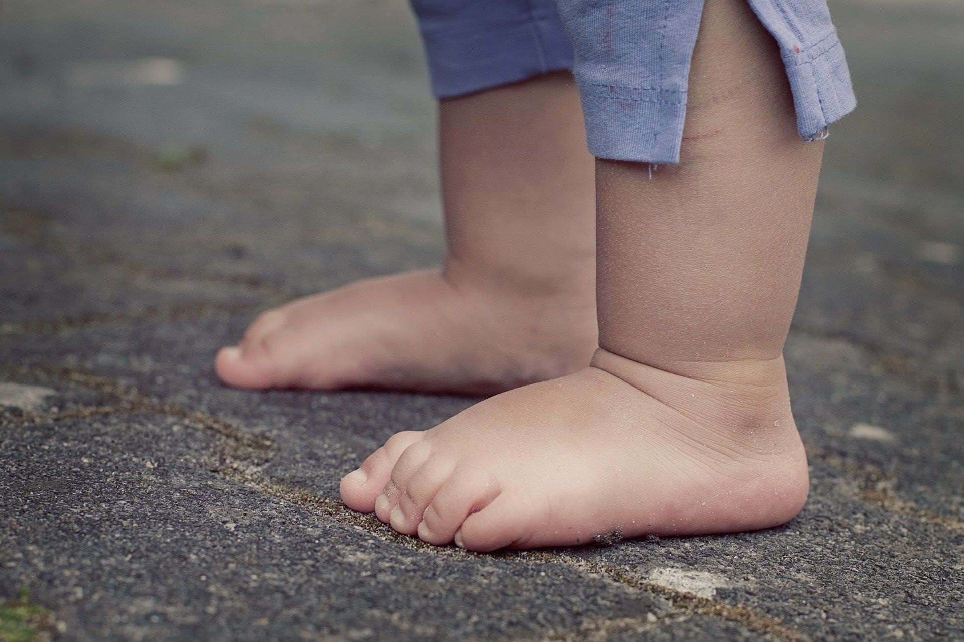 Patologias do Pé Infantil
