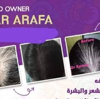 دكتور/سمر إنديان كلينيك زيوت هندى