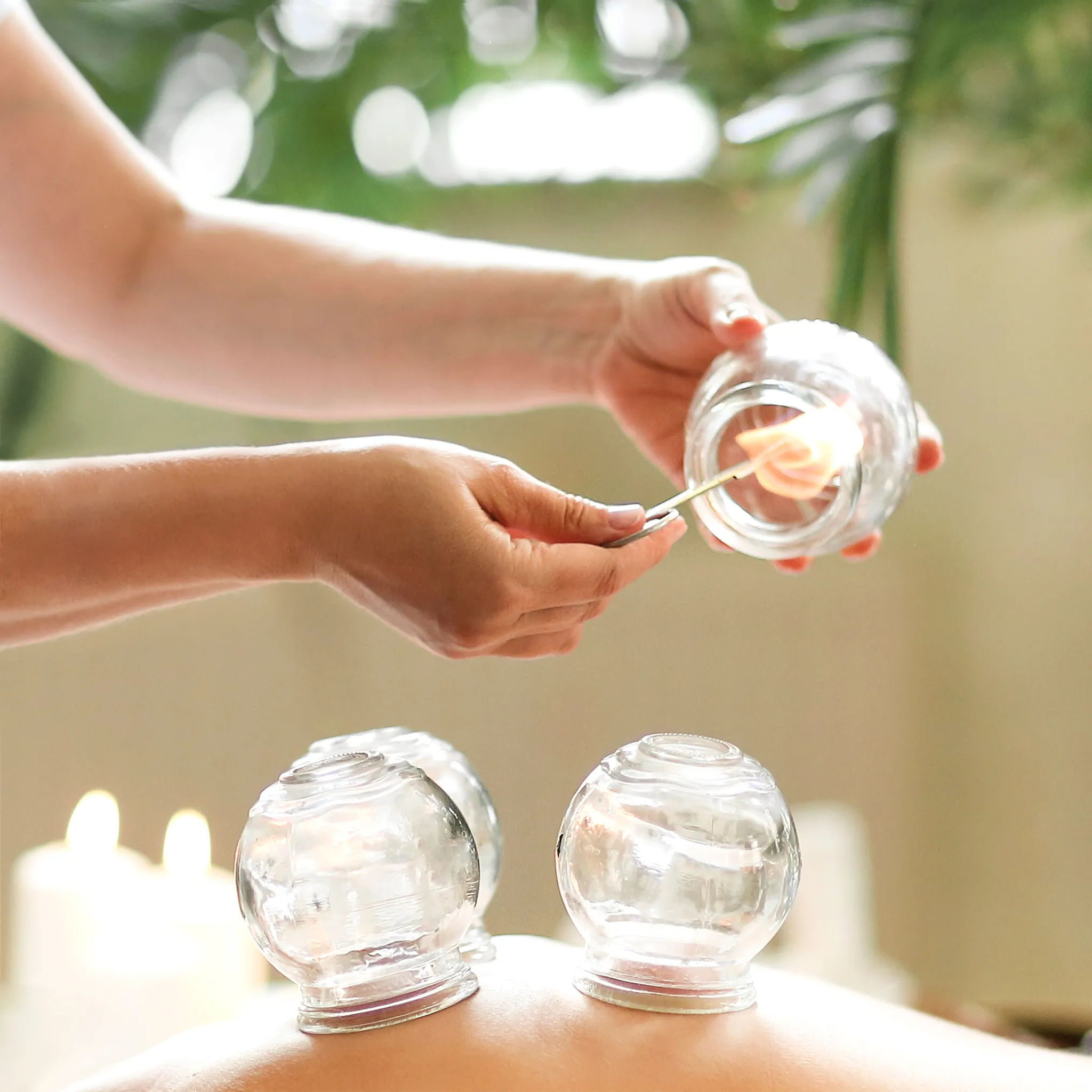 Massage Tuina avec ventouses et moxibustion - techniques traditionnelles chinoises