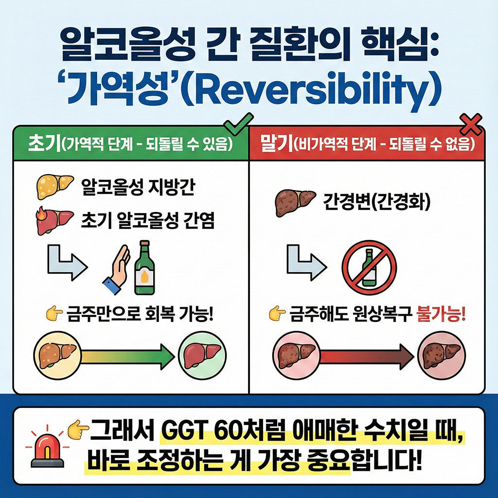 알코올성 간 질환의 핵심 : ‘가역성’