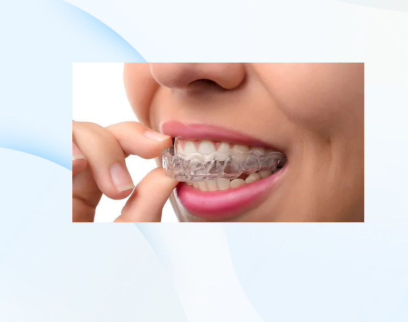 UDS - United Dental Surgery Implant and Braces Centre