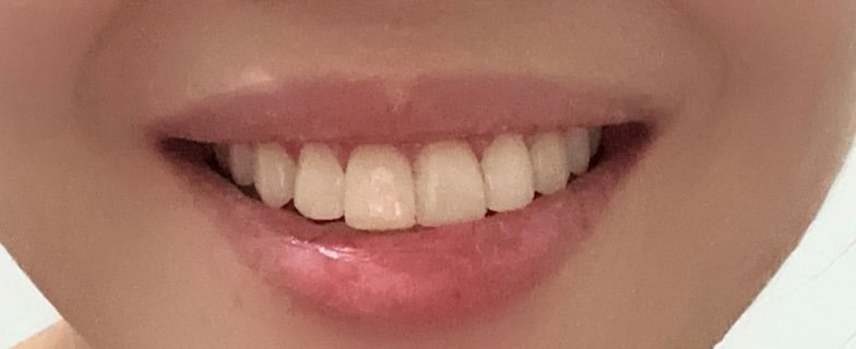 Photo 6 for Klinik Pergigian City Care Dental