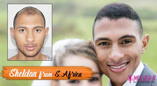 hair transplant videos