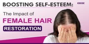 How To Get Rid Of Female Pattern Baldness Effectively?