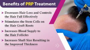 Explain the significance of PRP Hair Restoration