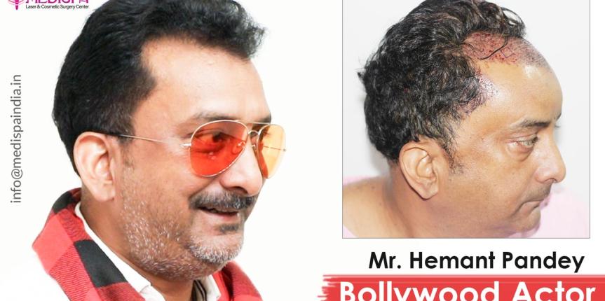 hemant pandey actor hair transplant