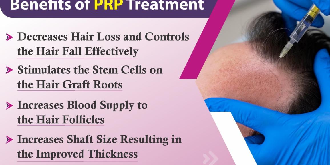 Explain the significance of PRP Hair Restoration