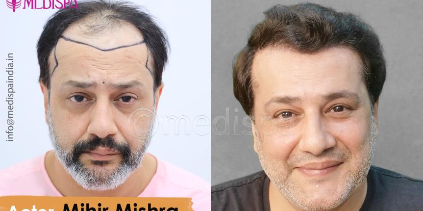 Celebrity-Mihir-Mishra