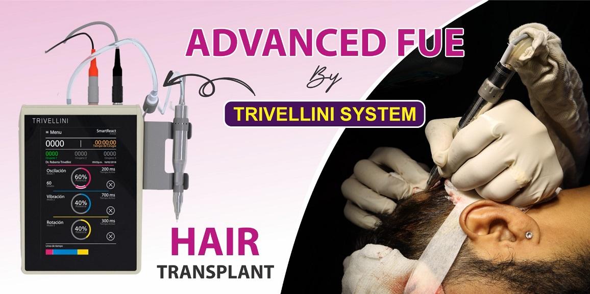 What Are The Qualities Of Advanced FUE Hair Transplant Technique?
