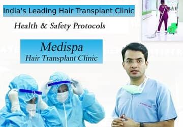 Hair Transplant in Delhi  Hair Transplant Cost in Delhi Clinic