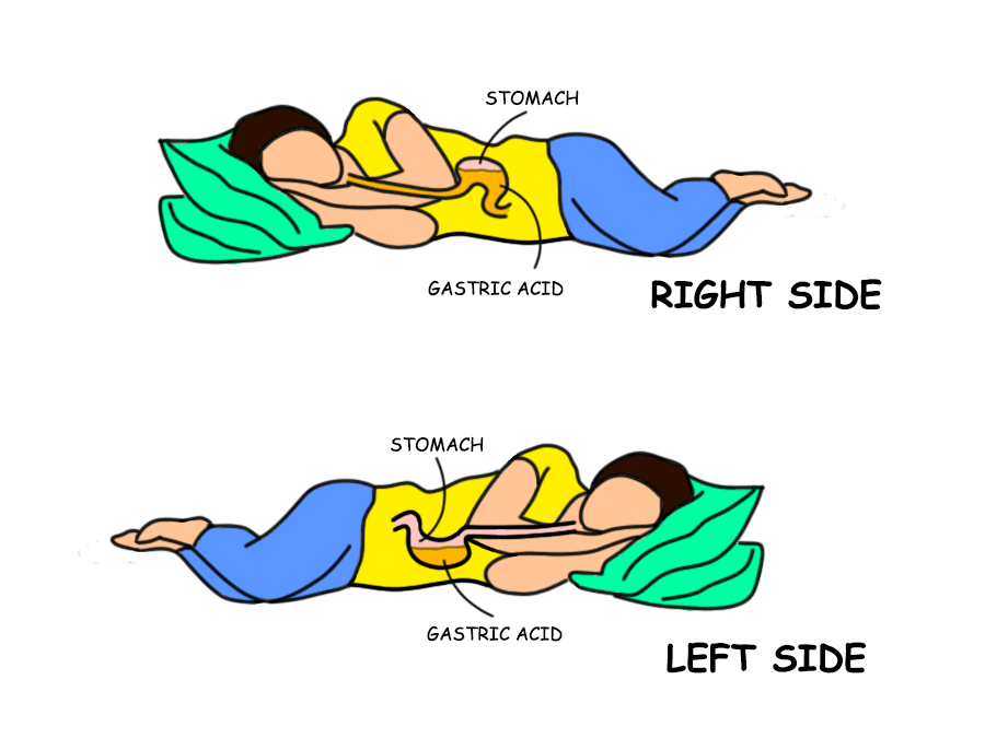 sleeping position for gas pain in chest