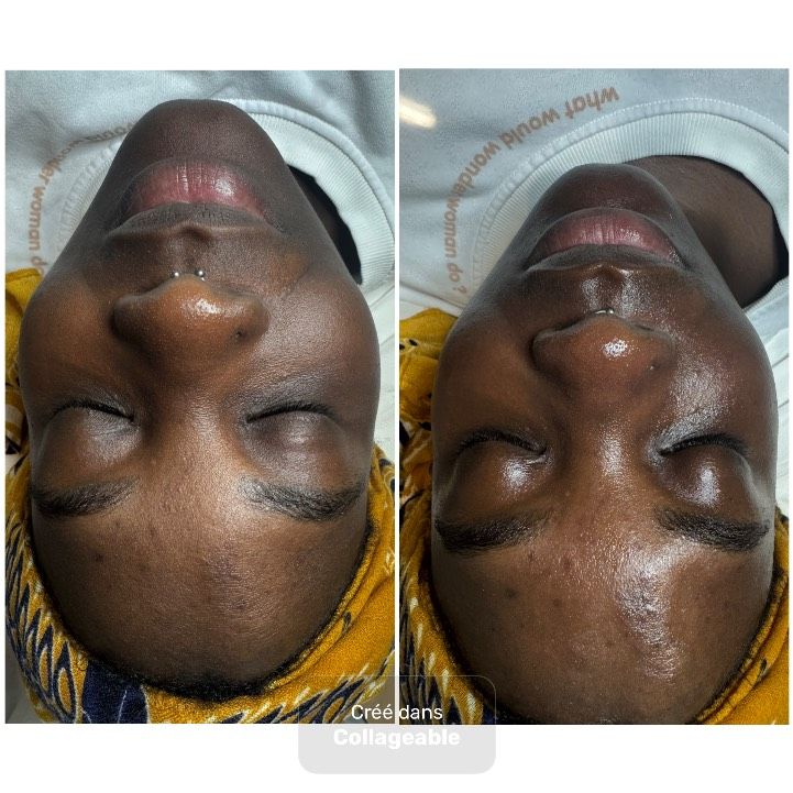 Soins de visage complet 
