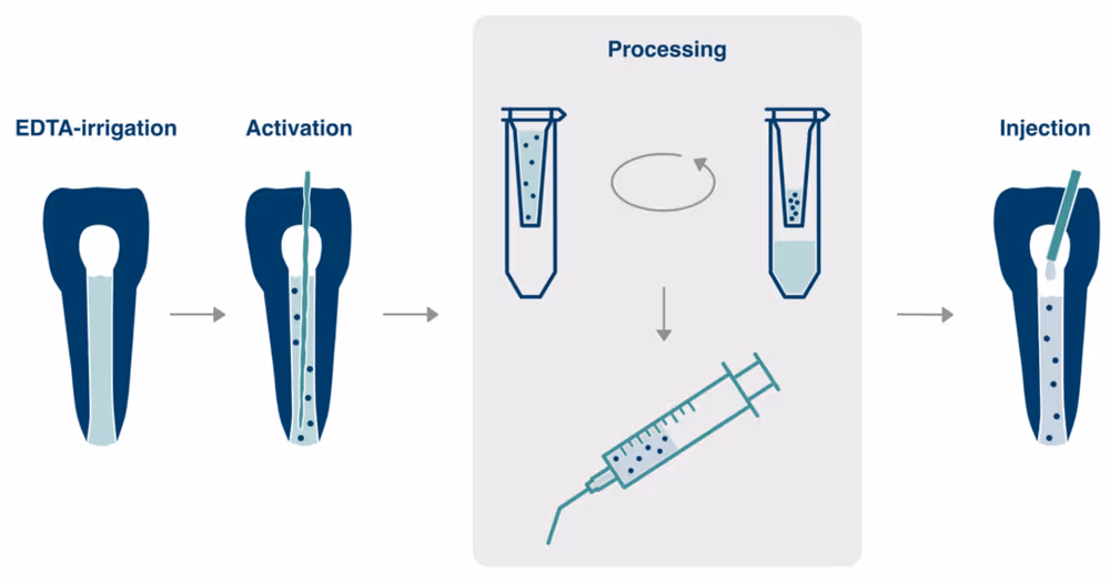 Vishal Dentocare V File Cream EDTA (Chelating Agent)