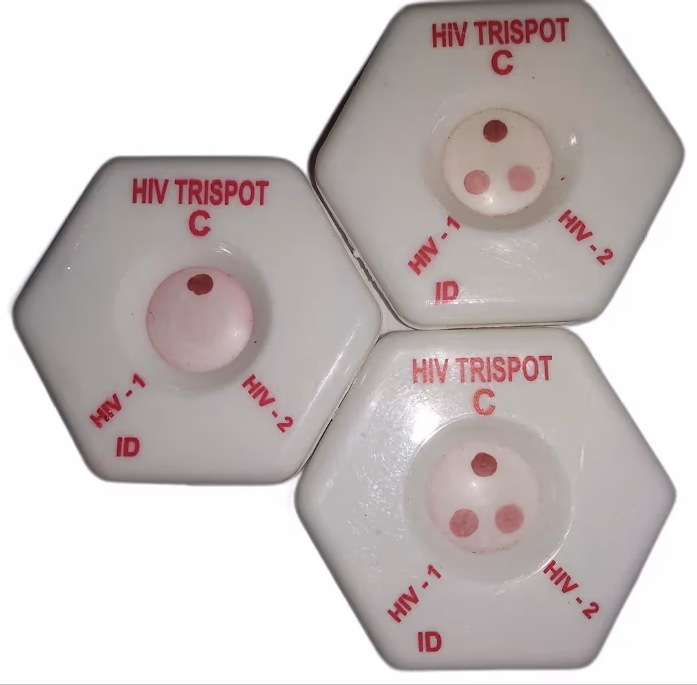 Aidscan HIV-1/2 Trispot Rapid Card - Pack of 50 Test (ATS)