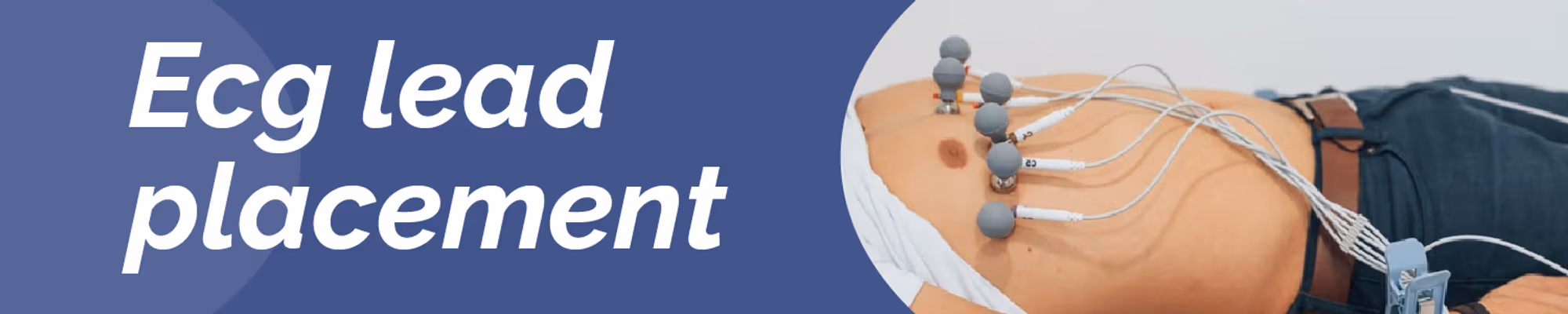 What do you mean by ECG Lead Placement?