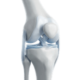 Orthopedics