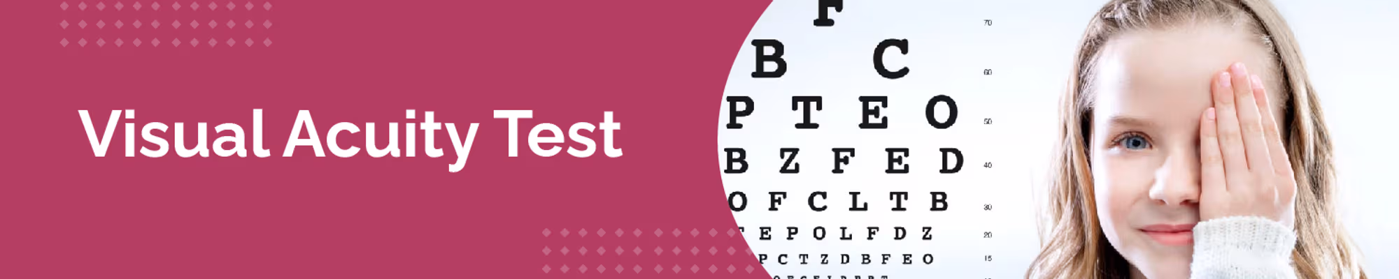 What is a Visual Acuity Test?
