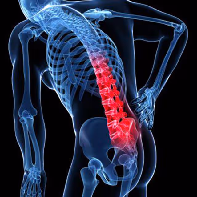 Spinal And Low Back Conditions