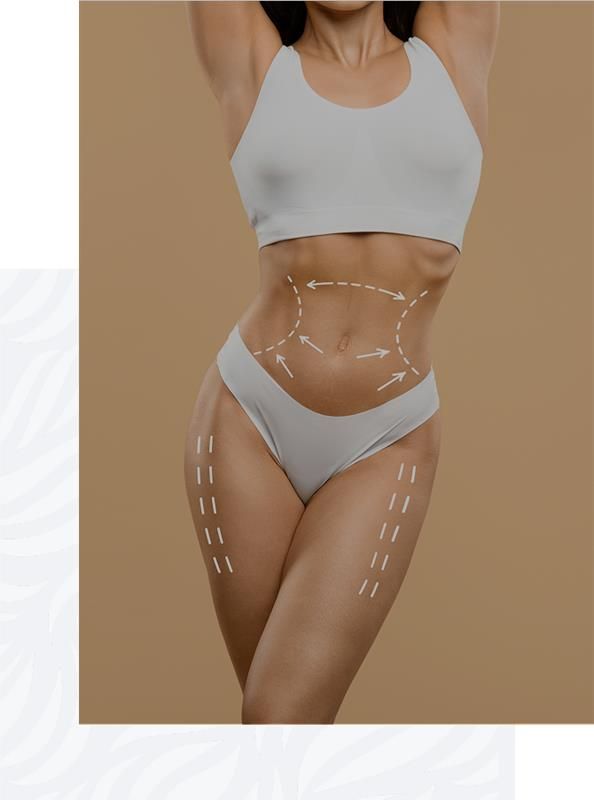 Inch_Loss_Made Easy Slim Sculpt Therapy