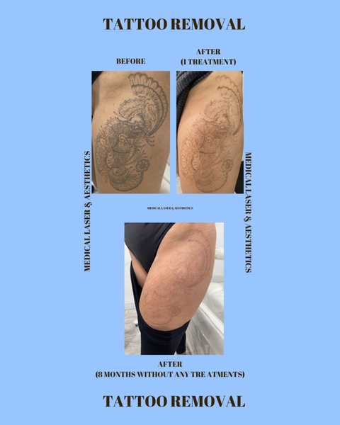 gallery image in our gallery